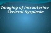 imaging in intrauterine skeletal dysplasia