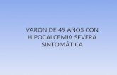 Sindrome de Gitelman. Hipocalcemia,hipomagnasemia e hipocalciuria.