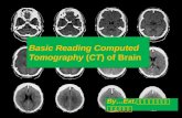 Basic reading computed tomography (ct) of brain