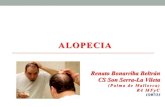 Alopecia presentacion