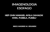 Imagenología de Esofago