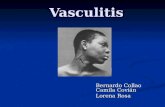 06 Disert. Vasculitis