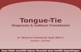 Diagnosis tongue tie & indikasi frenektomi