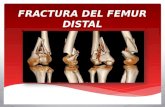 Fractura del femur distal