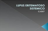 Lupus Eritematoso Sistemico CJ7