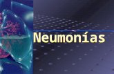 neumonias dr