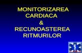 Monitorizarea Cardiaca&Recunoasterea Ritmurilor