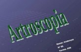 Artroscopia - Anderson