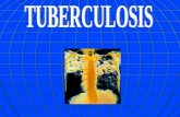 Tuberculosis , procesos pleurales, tromboembolismo
