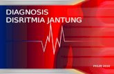 Diagnosis aritmia