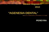 Agenesia Dental, Caso Clinico