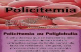 Policitemia - apresentação