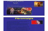 Fibromialgia Parte 1