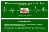 electrocardiograma y arritmia