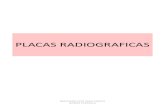 68035493 Placas Radiograficas Para Estudiar