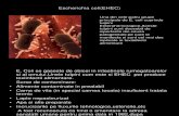 Escherichia coli(EHEC)