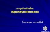 กระดูกสันหลังเคลื่อน (Spondylolisthesis)