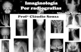 Aula 1 - Imaginologia por radiografias - mão-punho-antebraço-cotovelo. Profº Claudio Souza