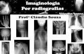 aula 5 Imaginologia por radiografias- Tornozelo, calcaneo, pe,antepe- ProfºClaudio Souza