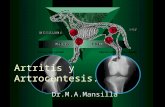 Artritis y Artrocentesis. Mansilla