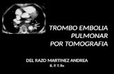 TROMBO EMBOLIA PULMONAR (2)
