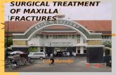 2 Surgical Treatment of Maxilla Fracture