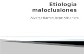Etiologia maloclusiones