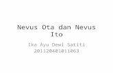 Nevus Ota dan Nevus Ito.ppt