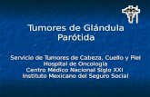 Consulta Tumores de Glándula Parótida