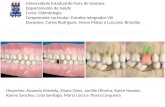 Posicionamento e oclusão dental