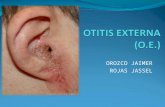 Otitis Externa OTL UCC-Santa Marta. Medicina