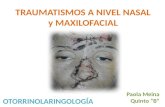 Trauma nasal y maxilofacial