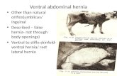 Ventral abdominal hernia1