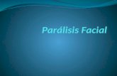 15 paralisis facial
