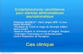 Endarteriectomie carotidienne pour sténose athéromateuse asymptomatique: