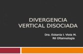 Divergencia vertical disociada