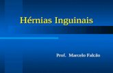 Hernia inguinais . dr. falcão