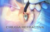 Cirugia refractiva