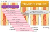 fracture colles