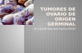 Tumores germinales de ovario leonel