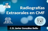 Radiografías en Cirugía Maxilofacial