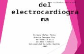 Electrocardiograma anormal