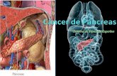 Cancer  páncreas y vesicula biliar