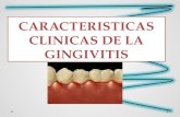 Gingivitis (caract clx)