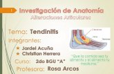 Anatomia - Tendinitis
