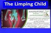 العرج عند الاطفال - Limping child - البروفيسور فريح ابوحسان - استشاري جراحة العظام وعظام الاطفال
