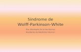 Sindrome de wolff parkinson-white
