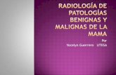 Radiologia de las Patologias benignas y malignas de la mama.