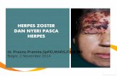 Herpes zoster dan nyeri pasca herpes by dr  prasna