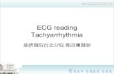 Arrhythmia: ECG-Tachycardia_20120909_中區